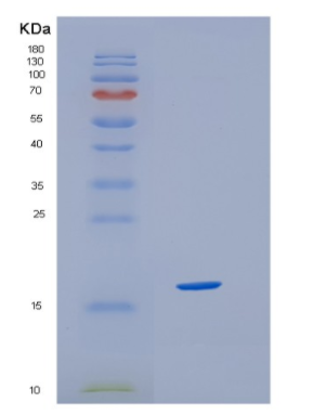 Recombinant Human HBQ1 Protein
