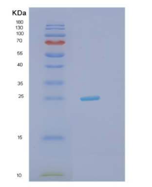 Recombinant Human HDDC2 Protein