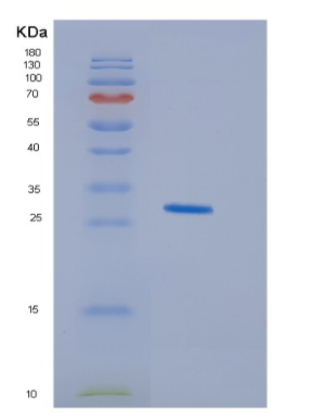 Recombinant Human HDGFL1 Protein