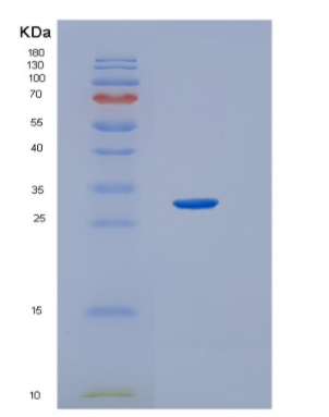 Recombinant Human Heme oxygenase1 Protein