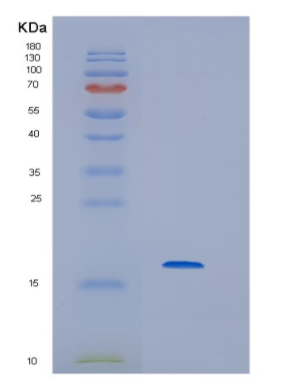 Recombinant Human HBG2 Protein