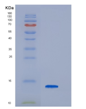 Recombinant Hepatitis C Virus HCV-NS5a Protein