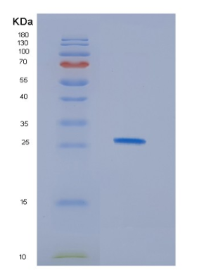 Recombinant Human HDHD1A Protein