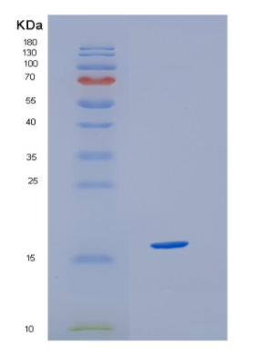 Recombinant Human HBZ Protein