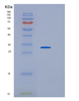 Recombinant Human HDHD3 Protein