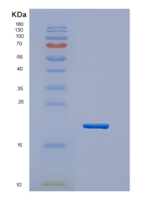 Recombinant Human HES2 Protein