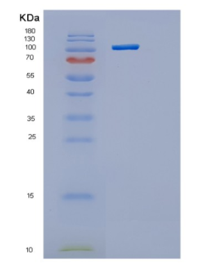 Recombinant Human Hexokinase 1 Human Protein