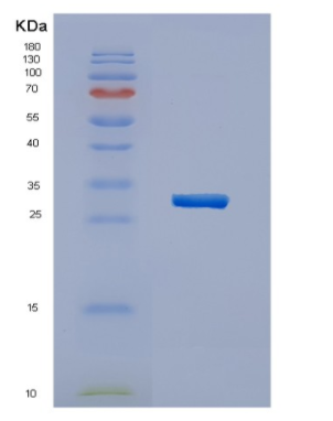 Recombinant Human HERPUD1 Protein