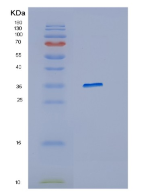 Recombinant Human HFE Protein