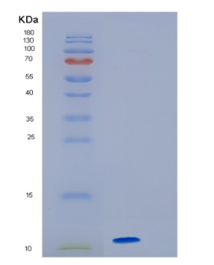 Recombinant Human HMGA2 Protein