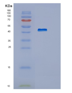 Recombinant Human HEXIM1 Protein