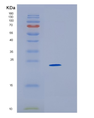 Recombinant Human HLA-DRA Protein