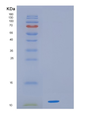 Recombinant Human HMGA1 Protein