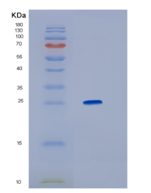 Recombinant Human HMGB1 Protein