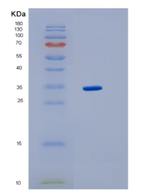 Recombinant Human HMGCL Protein