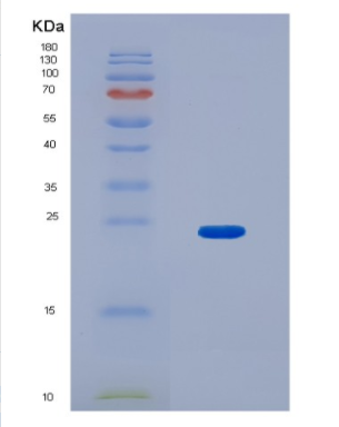 Recombinant Human HN1L Protein