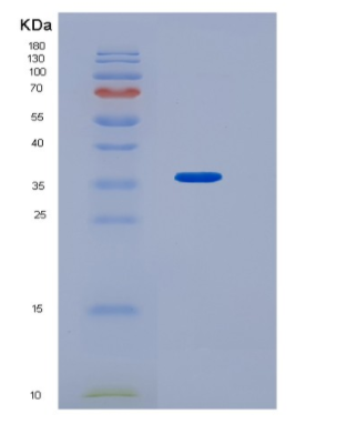 Recombinant Human HNMT Protein