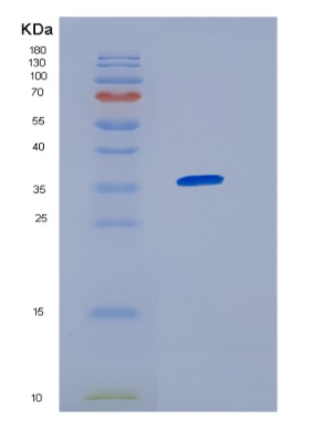 Recombinant Human HNRNPA1 Protein