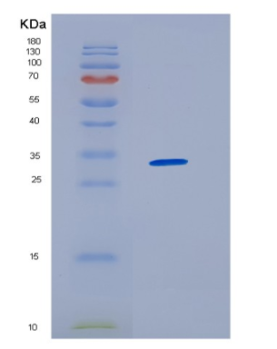 Recombinant Human HNRNPAB Protein
