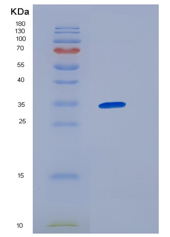Recombinant Human HNRNPC Protein