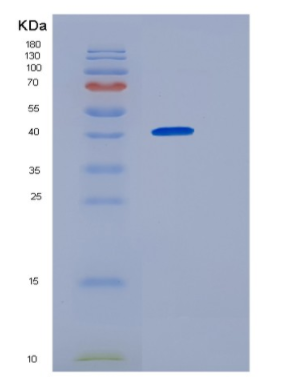 Recombinant Human Homer 1 Protein