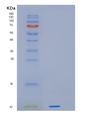 Recombinant Human HOPX Protein