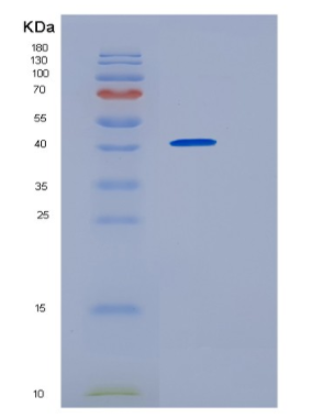 Recombinant Human HOMER2 Protein