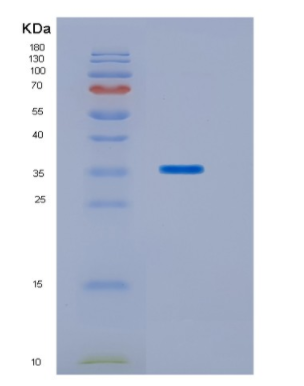 Recombinant Human HOXC11 Protein