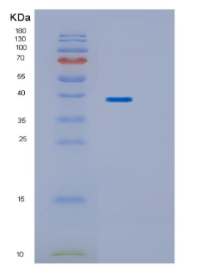 Recombinant Human HP Protein