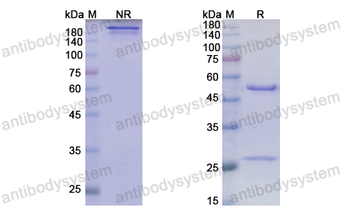 Anti-HRSV F/Fusion glycoprotein F0 Antibody (Am14) (RVV02801)