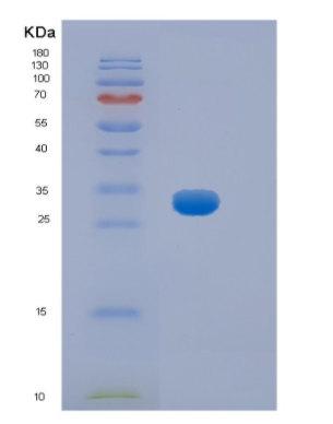 Recombinant Mouse Hpgd Protein