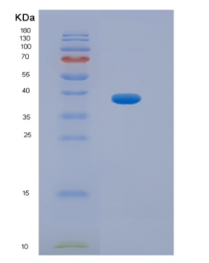 Recombinant Human HPR Protein