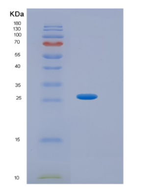 Recombinant Human HPRT Protein