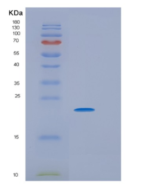 Recombinant Human HRAS Protein