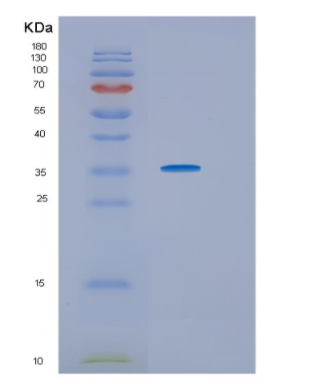 Recombinant Human HS3ST1 Protein