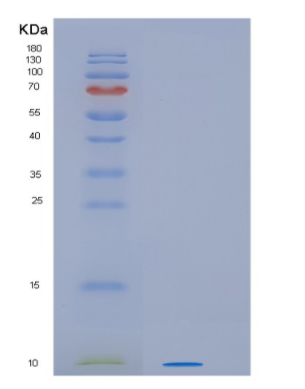 Recombinant Human HSBP1L1 Protein