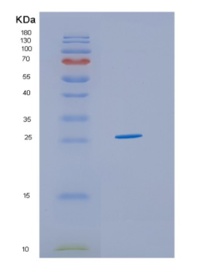 Recombinant Human HSCB Protein