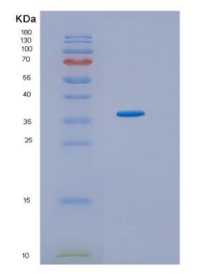 Recombinant Human HSD17B1 Protein