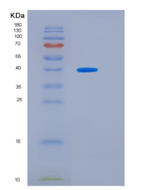 Recombinant Human HSF2BP Protein