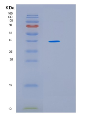Recombinant Human HSP40(DNAJ) Human Protein