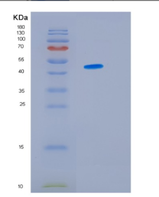 Recombinant Human HSP47(Colligin) Protein