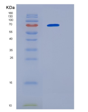 Recombinant Human HSP70B Protein