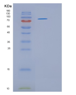 Recombinant Human HSP90B1(GRP94) Protein
