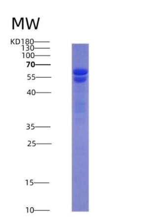 Recombinant Nuclear Mitotic Apparatus Protein 1 (NUMA1)