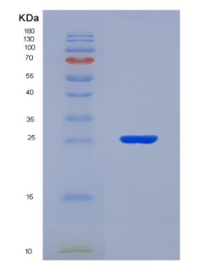 Recombinant Bovine Xanthine Dehydrogenase (XDH)