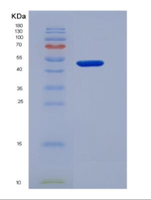 Recombinant Human Cholinergic Receptor, Nicotinic, Gamma (CHRNg)