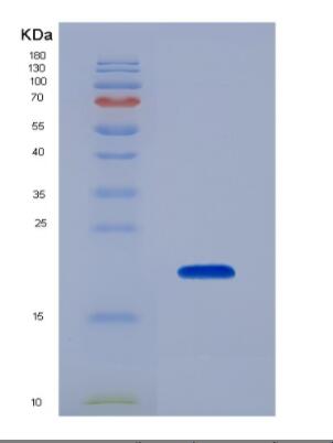 Recombinant Mouse Relaxin/Insulin Like Family Peptide Receptor 1 (RXFP1)