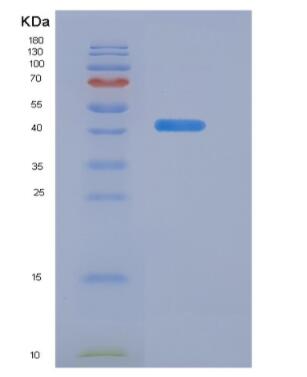 Recombinant Major outer membrane porin(ompA)