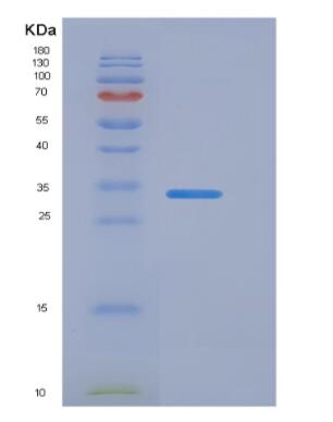 Recombinant Peptidylglycine Alpha Amidating Monooxygenase (PAM)