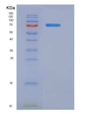 Recombinant Alpha-Fetoprotein (AFP)